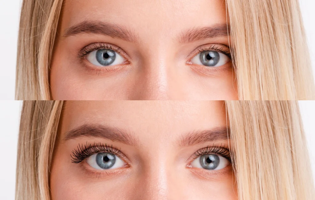 Before & After